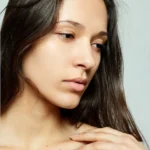 la alopecia se puede frenar