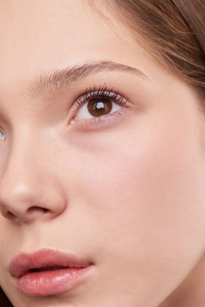 Zona facial donde se aplica la carboxiterapia en medicina estética